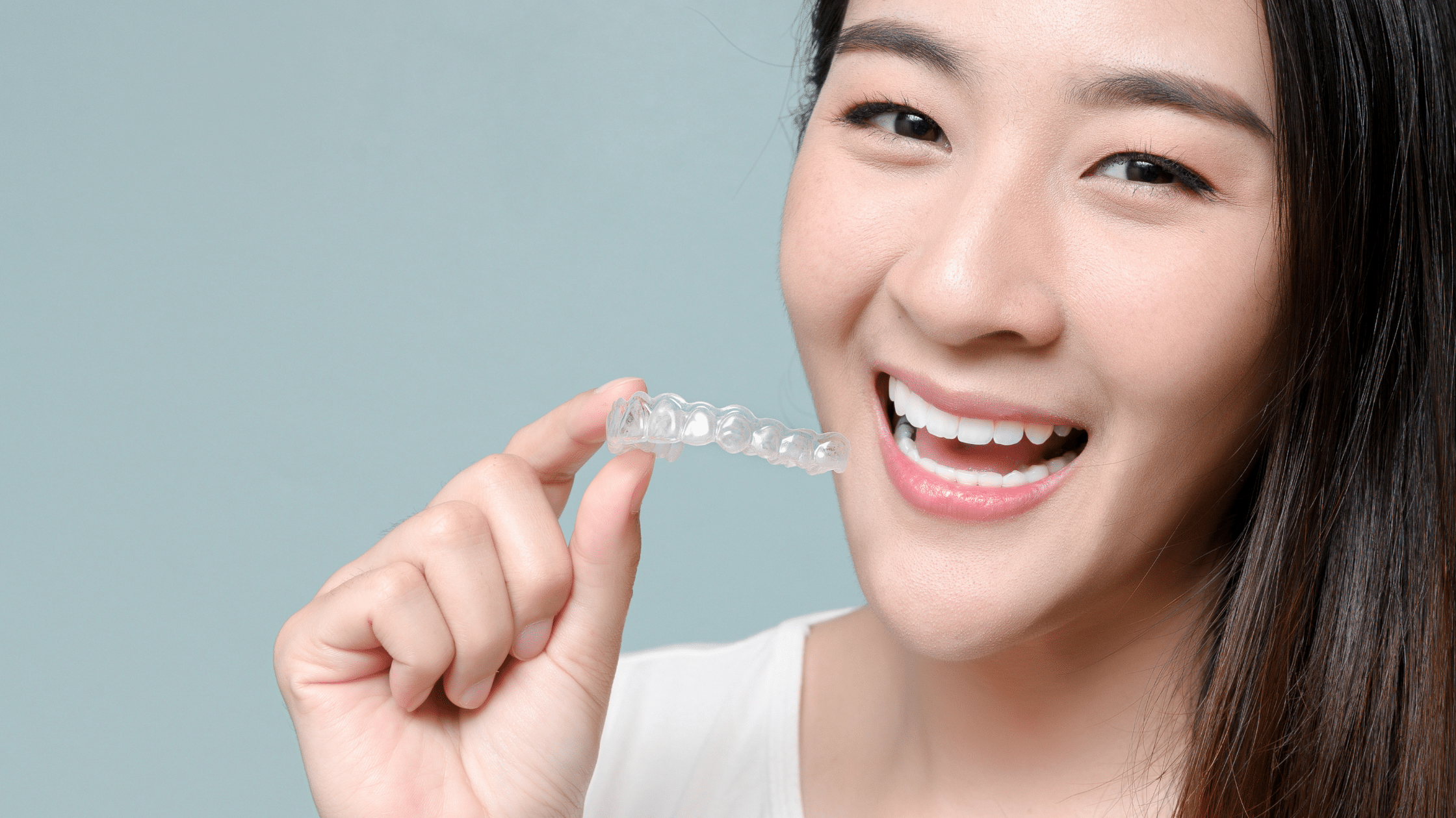 7 Common Questions About Clear Aligners